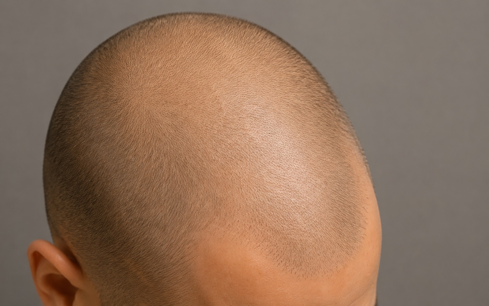 Scalp anatomy cover